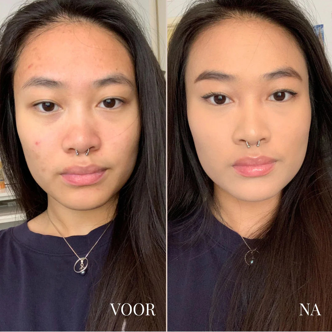 Glamora OogGlans | #1 Product voor ogen die altijd wakker en verfrist lijken