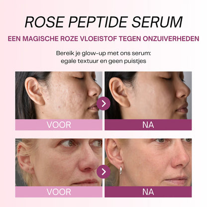 Glamora #1 PDRN Pink Peptide Serum | De Koreaanse Glass Skin Reset