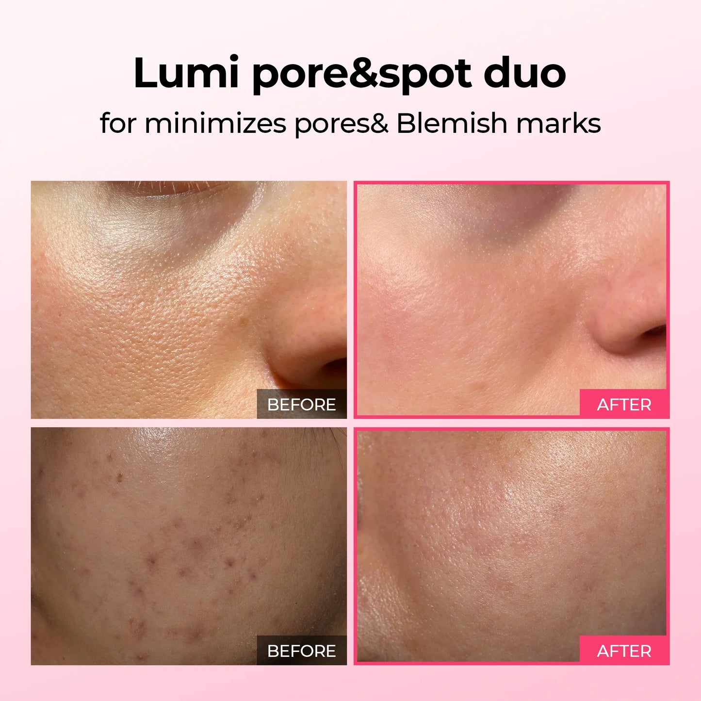 Glamora #1 Lumi-Duo | Wis hardnekkige pigmentatie en grove poriën direct