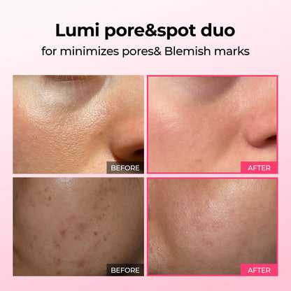 Glamora #1 Lumi-Duo | Wis hardnekkige pigmentatie en grove poriën direct